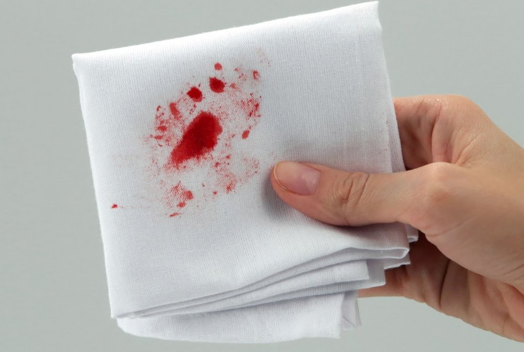 Как отстирать кровь с одежды